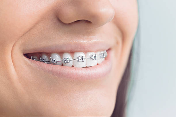 Morgan Hill, CA Holistic Dental Care Services Company